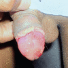 Figure 3a