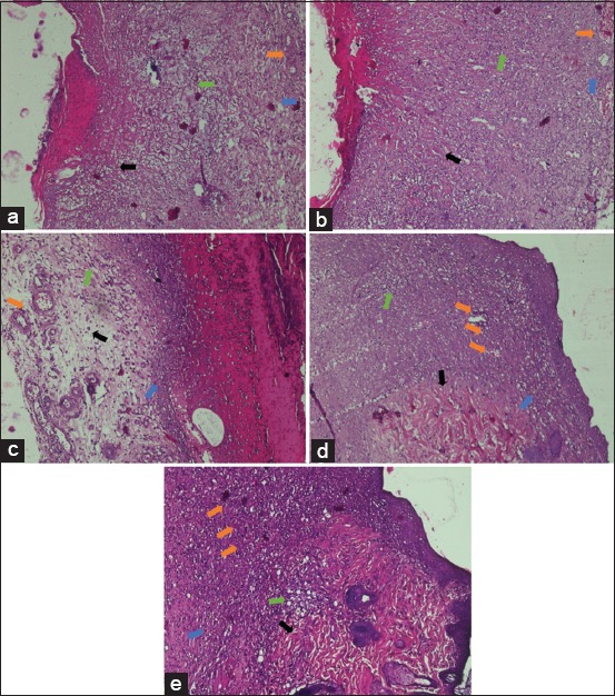 Figure-1