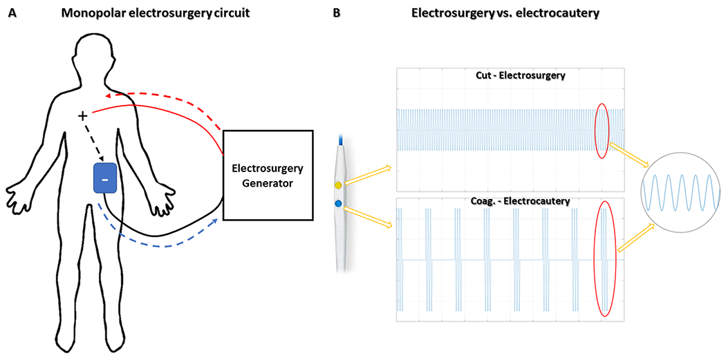 Fig 2.