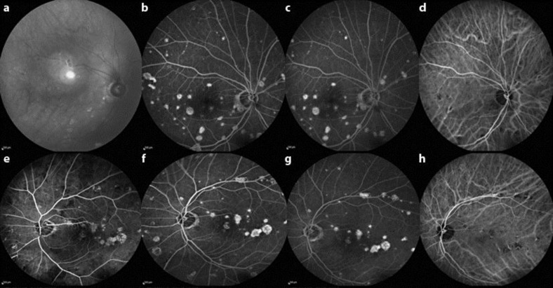 Fig. 1