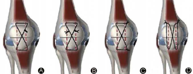 Fig. 1