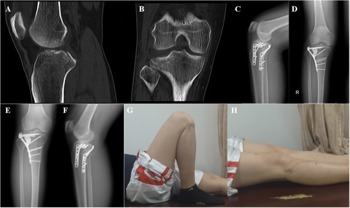 Fig. 5