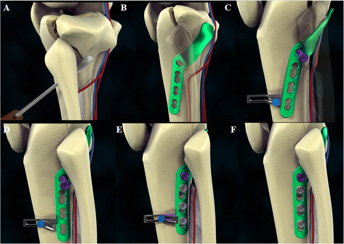 Fig. 4