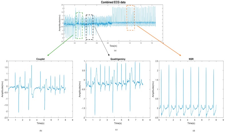 Figure 14