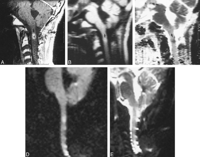 fig 2.