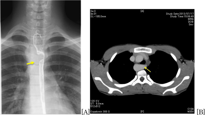 Fig. 1