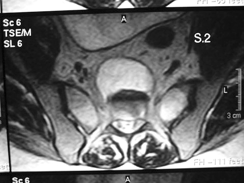 Fig. 2