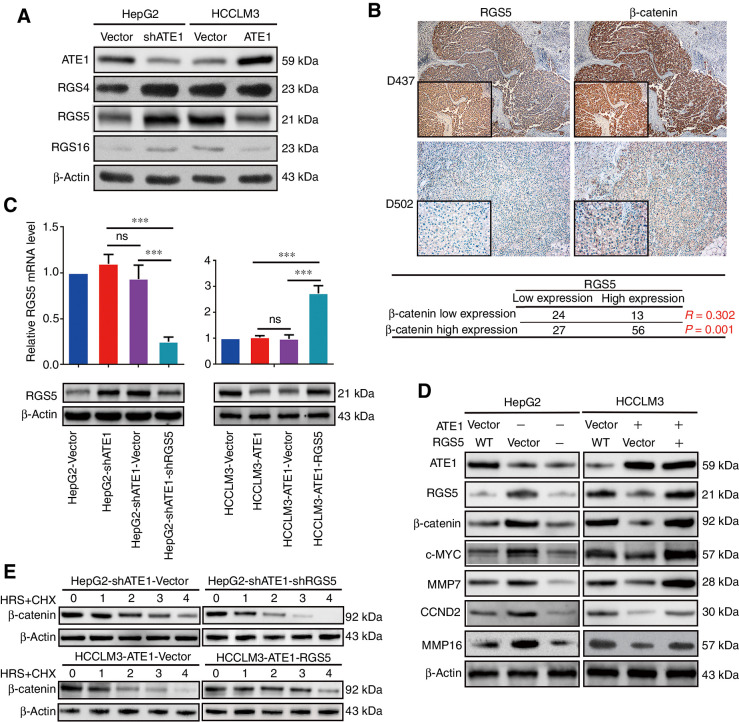 Figure 5. RGS5 is the key downstream of ATE1 to regulate the deregulation of β-catenin. A, The expressions of ATE1 and its downstream proteins RGS4, RGS5, RGS16 were detected by indicated antibodies. B, Representative IHC images of RGS5 and β-catenin expression in HCC serial slices. Magnification, 100×; inset magnification, 400×. The correlation analysis between RGS5 and β-catenin was shown in the table below. C, The expression of ATE1 was determined by real-time PCR and Western blot analysis, respectively in RGS5-intervened HepG2-shATE1 and HCCLM3-ATE1 cell lines. D, The expression of β-catenin and its representative downstream proteins were monitored in with or without RGS5 intervening cell lines by Western blot analysis using the indicated antibodies. E, HCC cells were treated with cycloheximide at different time points as indicated followed by Western blot analysis using the indicated antibodies.