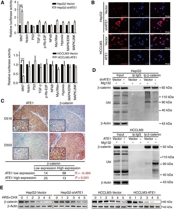 Figure 4. ATE1 inhibits Wnt signaling pathway by accelerating the deregulation of β-catenin. A, The 10-Pathway Reporter Array showed the signaling change in ATE1-interfered cells. B, IF assays to show the expression and distribution of β-catenin in liver cancer cell lines with ATE1 knockdown or ectopic expression. C, Representative IHC images of ATE1 and β-catenin expression in HCC serial slices. Magnification, 100×; inset magnification, 400×. The correlation analysis between ATE1 and β-catenin was shown in the table below. D, Liver cancer cells were treated with MG132. Samples were immunoprecipitated with β-catenin antibody and IgG as control followed by Western blot analysis using the indicated antibodies. E, Liver cancer cells were treated with cycloheximide at different time points as indicated followed by Western blot analysis using the indicated antibodies.