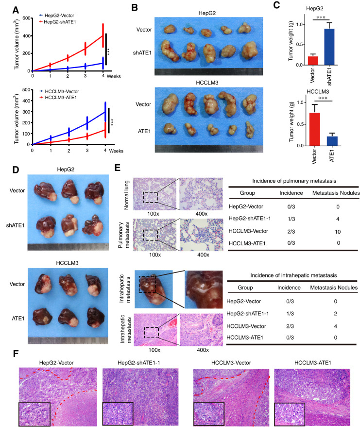 Figure 3. ATE1 inhibits the growth and correlates with low-grade malignancy of liver cancer in vivo. A, Subcutaneous xenograft tumors from HepG2-shATE1 and HCCLM3-ATE1 cells and their control cells were established in nude mice. The volumes of subcutaneous tumors were measured per week and calculated according to the following equation: V (mm3) = width2 (mm2) × length (mm)/2. The growth curves are shown. B, Subcutaneous tumors from HepG2-shATE1 and HCCLM3-ATE1 cells and their control cells were removed and shown. C, The histograms showed the weight and statistical analysis of subcutaneous tumors. D, Orthotopic tumors were established using subcutaneous tumors and removed after 6 weeks. Each indicated groups are shown. Tumor volumes of tumors are shown in the right panels. *, P < 0.05; **, P < 0.01; ***, P < 0.001 based on the Student t test. Error bars, SD. E, Representative images of H&E staining in normal lung tissue and pulmonary metastasis sections from orthotopic tumor models were shown (top left). The incidence and the total metastasis nodules of pulmonary metastasis were shown (top, right). Representative images of intrahepatic metastasis and H&E staining in intrahepatic metastasis tissues (bottom left). The incidence and the total metastasis nodules of intrahepatic metastasis were shown (bottom, right). F, Representative images of H&E staining in tissue sections from orthotopic tumors were shown. Magnification, 100×; inset magnification, 400×.