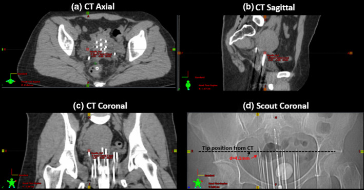 FIG. 4