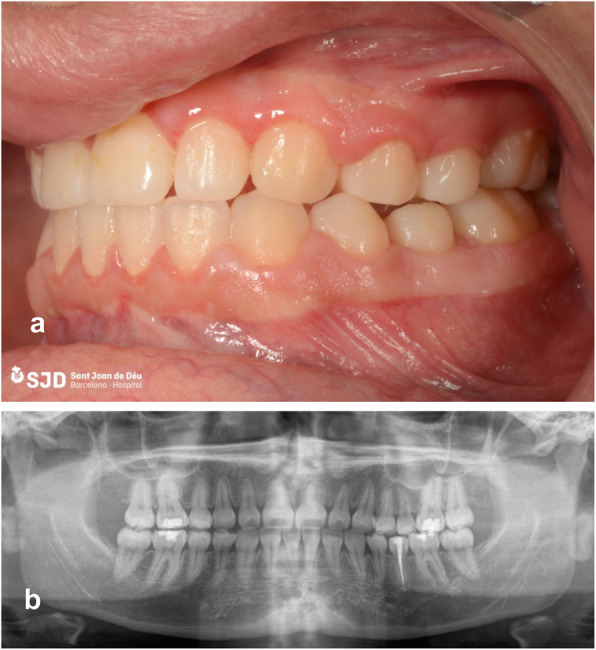 Fig. 7