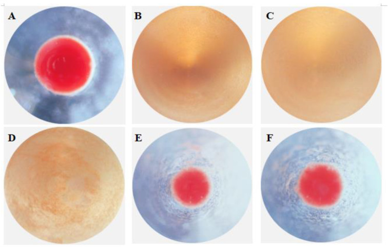 Figure 11