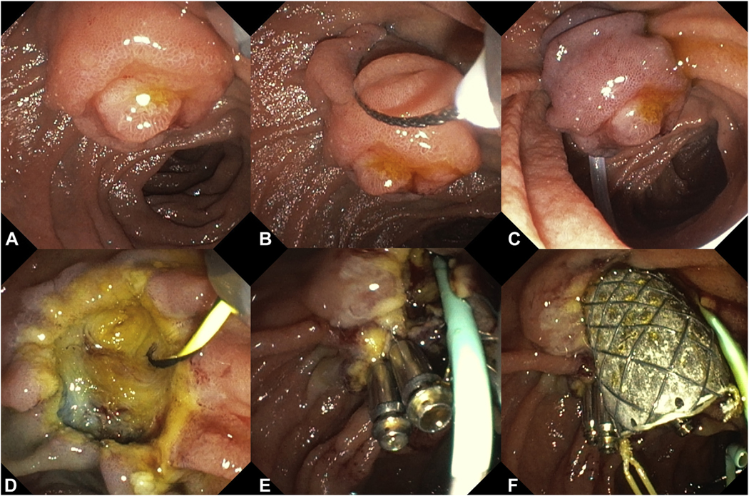 Figure 4.