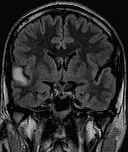 Fig. 5