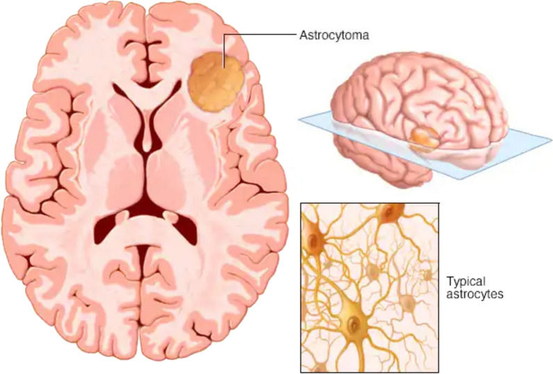 Fig. 1