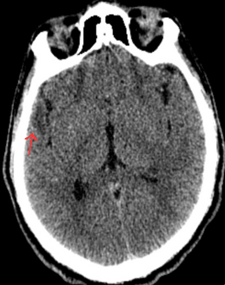 Fig. 3