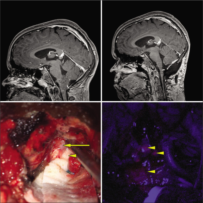 Figure 2: