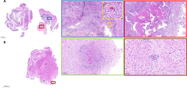 Fig 3