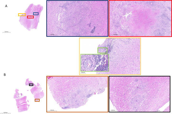 Fig 4