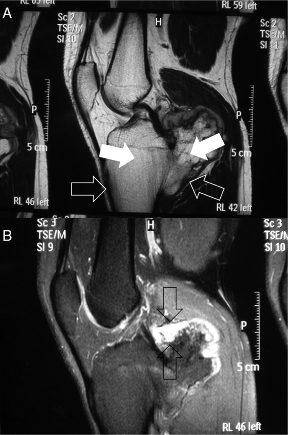 Fig. 11