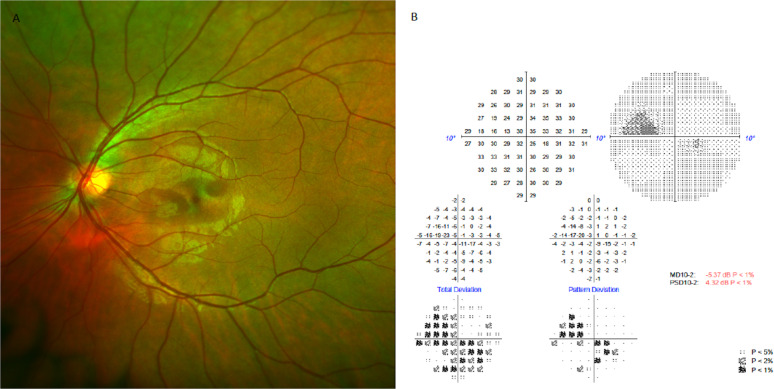 Fig. 1