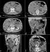 Fig. 3