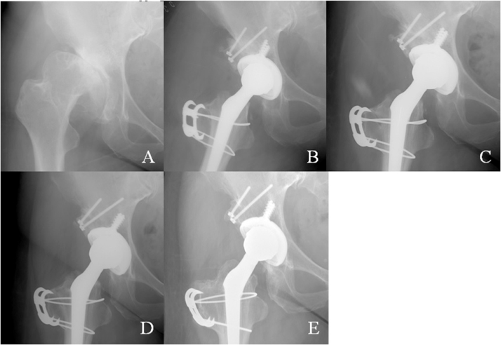 Fig. 3