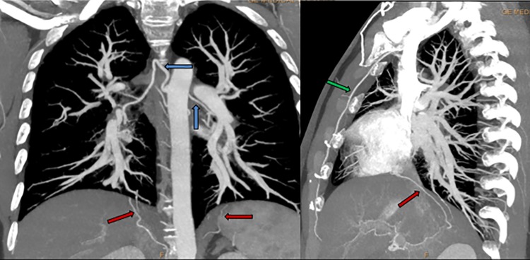 Fig 12