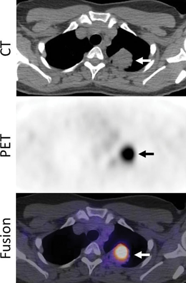 Figure 11a: