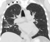 Figure 4b: