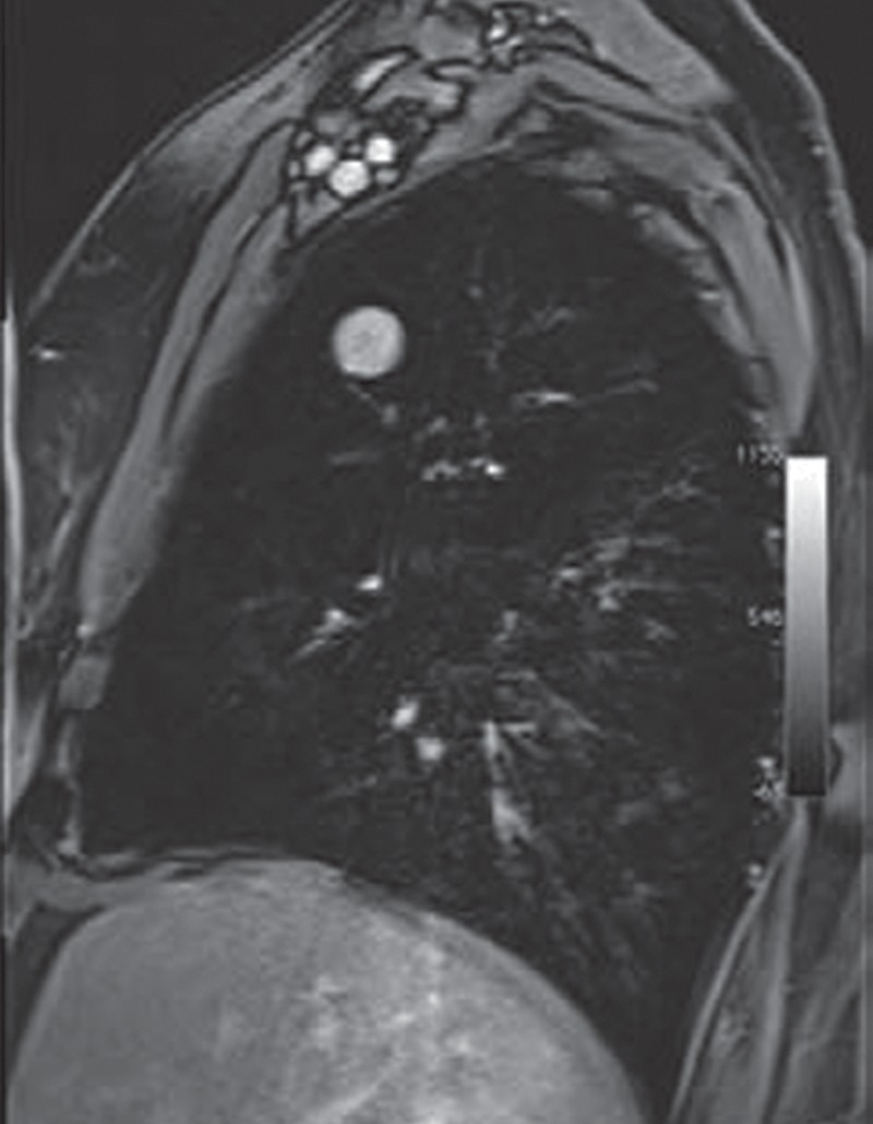 Figure 10b: