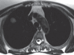 Figure 10a: