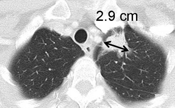 Figure 7a: