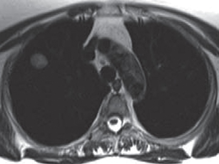 Figure 10a: