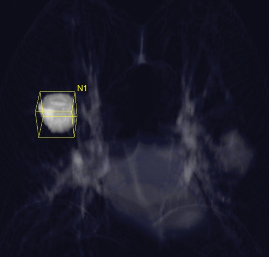 Figure 9b: