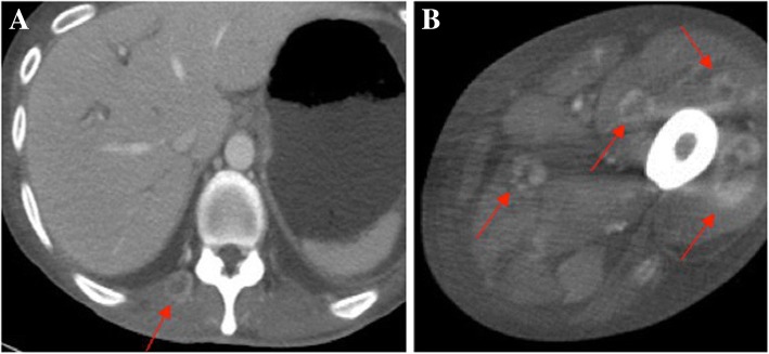 Fig. 4