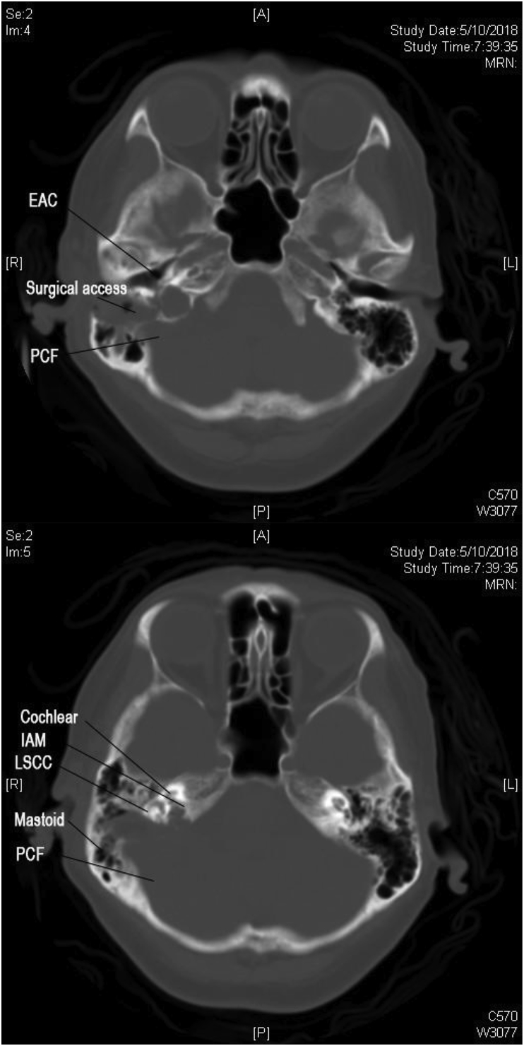 Fig. 6