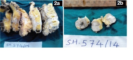 [Table/Fig-2a,b]: