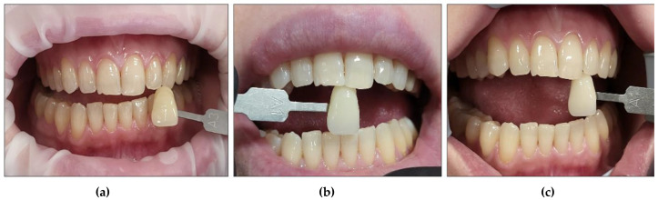 Figure 20