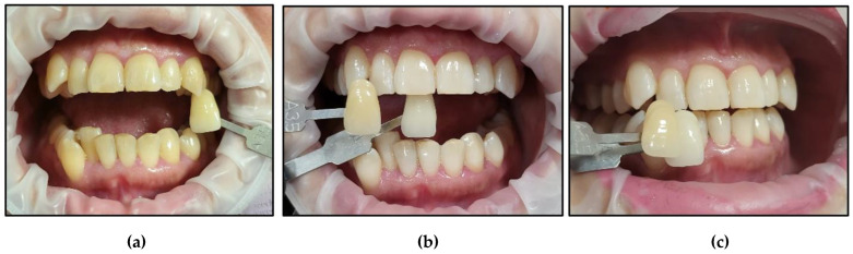 Figure 15