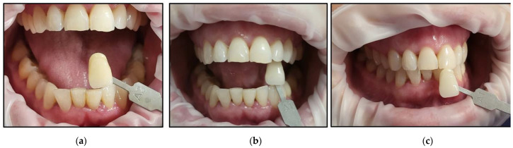 Figure 19