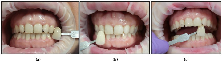 Figure 18