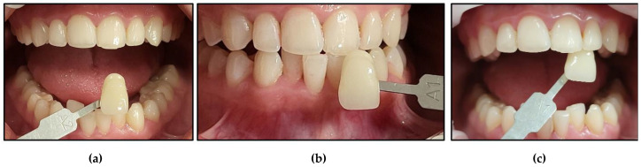 Figure 16