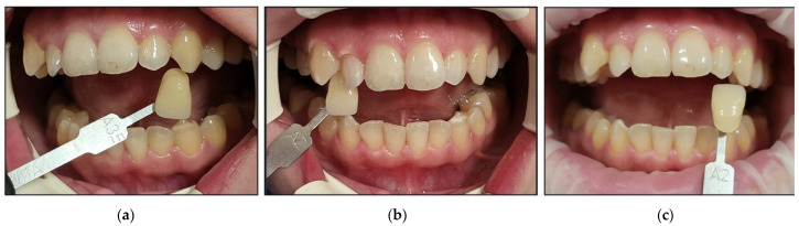 Figure 17