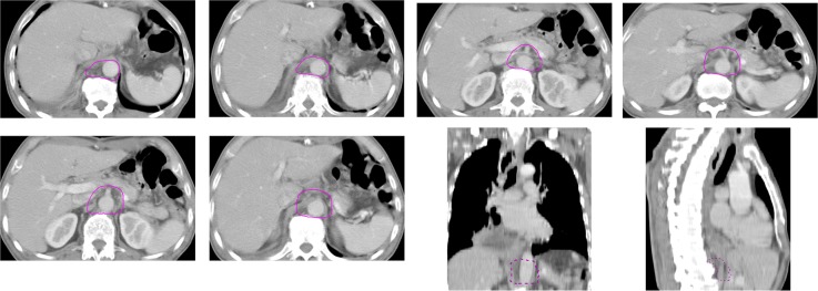 Fig 3