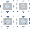Figure 21