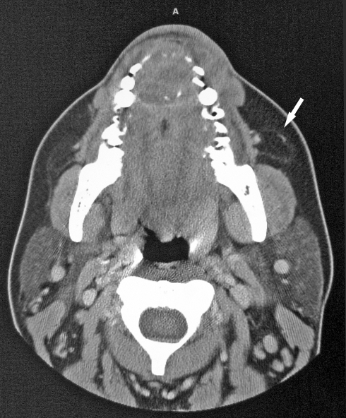 Fig. 1