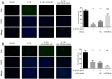 In the provided images, human chondrocytes were transfected with either miR-708-5p mimics or inhibitor, and subsequently treated with IL-1B for 24 hours to assess cell proliferation using EdU incorporation assay. The experiment showed a significant inhibition of cell proliferation by miR-708-5p compared to all controls, as demonstrated by the lower percentage of EdU-positive cells in the graphs. This suggests that miR-708-5p negatively regulates chondrocyte proliferation under IL-1B stimulation.
