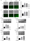 The image presents a scientific study examining the effects of miR-708-5p on IL-1β-induced oxidative stress and NOX4/NF-κB signaling.